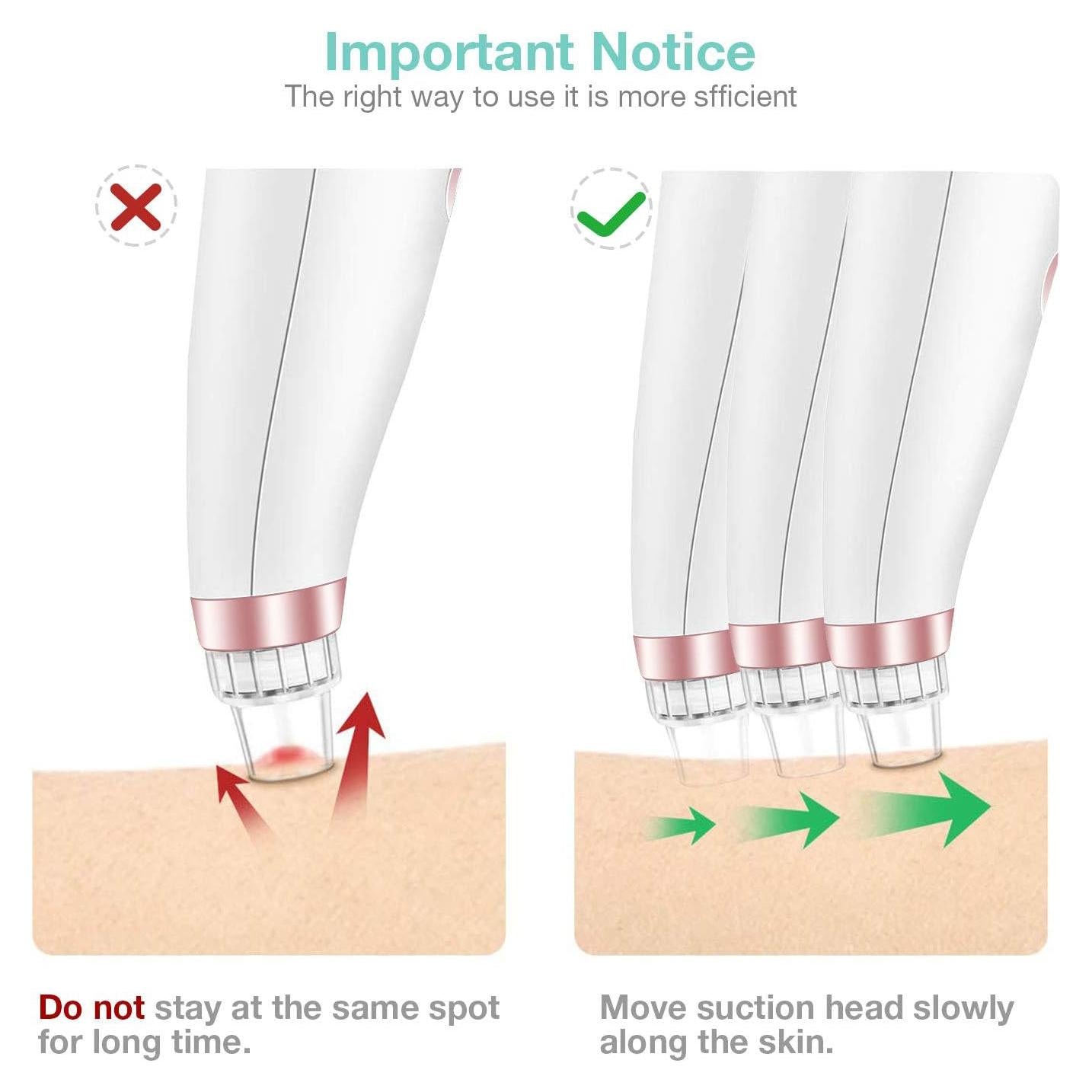 5-in-1 Blackhead & Spot Remover for Face Cleaning, Face Slimming with Multifunction