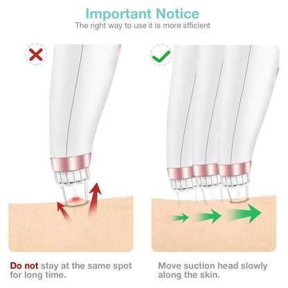 5-in-1 Blackhead & Spot Remover for Face Cleaning, Face Slimming with Multifunction