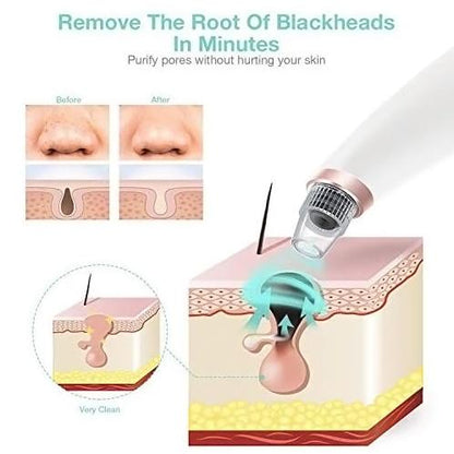 5-in-1 Blackhead & Spot Remover for Face Cleaning, Face Slimming with Multifunction
